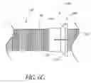 Fig. 09 - Method and apparatus for spinal fixation