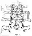 Fig. 04 - Apparatus and method for spine fixation