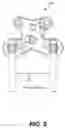 Fig. 06 - Apparatus and method for spine fixation