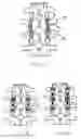 Fig. 13 - Method and apparatus for flexible fixation of a spine