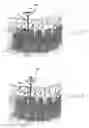 Fig. 17 - Method and apparatus for flexible fixation of a spine