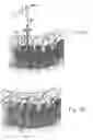 Fig. 19 - Method and apparatus for flexible fixation of a spine