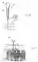 Fig. 22 - Method and apparatus for flexible fixation of a spine