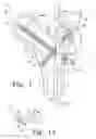 Fig. 02 - Intramedullary nail