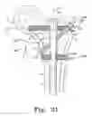 Fig. 20 - Multiple purpose nail, nail assembly and associated method