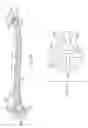 Fig. 20 - Inflatable Device for Restoring Anatomy of Fractured Bone