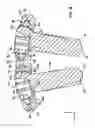 Fig. 05 - Bone plate system