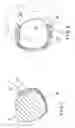 Fig. 05 - Bone fixation device and method