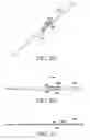 Fig. 06 - Flexible tissue rasp
