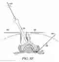 Fig. 35 - Flexible tissue rasp
