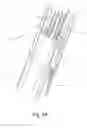 Fig. 03 - Mechanical cavity-creation surgical device and methods and kits for using such devices