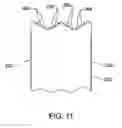 Fig. 11 - Surgical sagittal saw blade with angled teeth and chip catchment and reciprocating saw blade with broached teeth