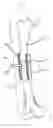 Fig. 02 - Bone regeneration device for bones, and method of use