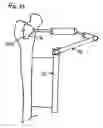 Fig. 18 - Method of resecting bone