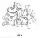 Fig. 03 - Guide and blade for contouring vertebral bodies