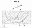 Fig. 07 - Medical Device installation tool and methods of use