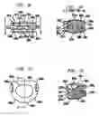 Fig. 02 - Inserter/impactor for implanting an artificial intervertebral disc