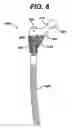 Fig. 08 - Assembly tool for modular implants, kit and associated method