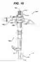 Fig. 10 - Assembly tool for modular implants, kit and associated method