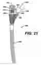 Fig. 21 - Assembly tool for modular implants, kit and associated method