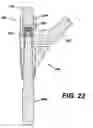 Fig. 22 - Assembly tool for modular implants, kit and associated method
