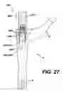 Fig. 26 - Assembly tool for modular implants, kit and associated method