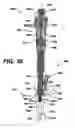 Fig. 38 - Assembly tool for modular implants, kit and associated method