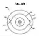 Fig. 48 - Assembly tool for modular implants, kit and associated method