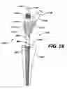 Fig. 57 - Assembly tool for modular implants, kit and associated method