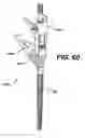 Fig. 58 - Assembly tool for modular implants, kit and associated method