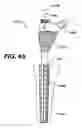 Fig. 63 - Assembly tool for modular implants, kit and associated method