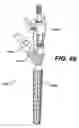 Fig. 64 - Assembly tool for modular implants, kit and associated method