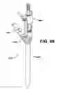 Fig. 67 - Assembly tool for modular implants, kit and associated method
