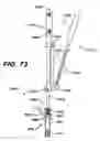 Fig. 71 - Assembly tool for modular implants, kit and associated method