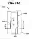 Fig. 74 - Assembly tool for modular implants, kit and associated method