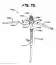 Fig. 75 - Assembly tool for modular implants, kit and associated method