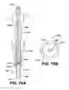 Fig. 76 - Assembly tool for modular implants, kit and associated method