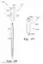 Fig. 90 - Assembly tool for modular implants, kit and associated method