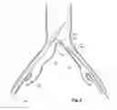 Fig. 07 - Stent graft introducer