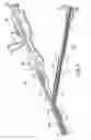 Fig. 04 - Catheter