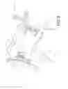 Fig. 03 - Surgical navigation systems and processes for unicompartmental knee arthroplasty