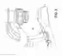 Fig. 04 - Surgical navigation systems and processes for unicompartmental knee arthroplasty