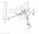 Fig. 13 - Surgical navigation systems and processes for unicompartmental knee arthroplasty