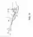 Fig. 14 - Surgical navigation systems and processes for unicompartmental knee arthroplasty