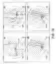 Fig. 20 - Surgical navigation systems and processes for unicompartmental knee arthroplasty