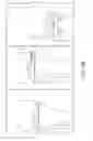 Fig. 40 - Surgical navigation systems and processes for unicompartmental knee arthroplasty