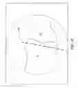 Fig. 42 - Surgical navigation systems and processes for unicompartmental knee arthroplasty
