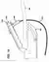 Fig. 13 - Tissue grasper/suture passer instrument