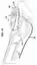 Fig. 16 - Tissue grasper/suture passer instrument