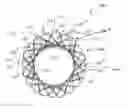 Fig. 01 - ANASTOMOTIC DEVICE PROMOTING TISSUE NECROSIS